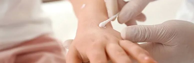 peeling des mains dr cayatte medecin esthetique à montpellier