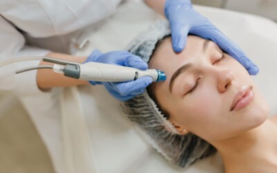 Le soin Microneedling à Montpellier